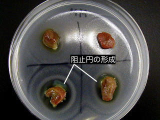 精密検査3