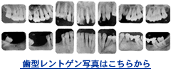 被害者の歯形レントゲン写真へのリンク